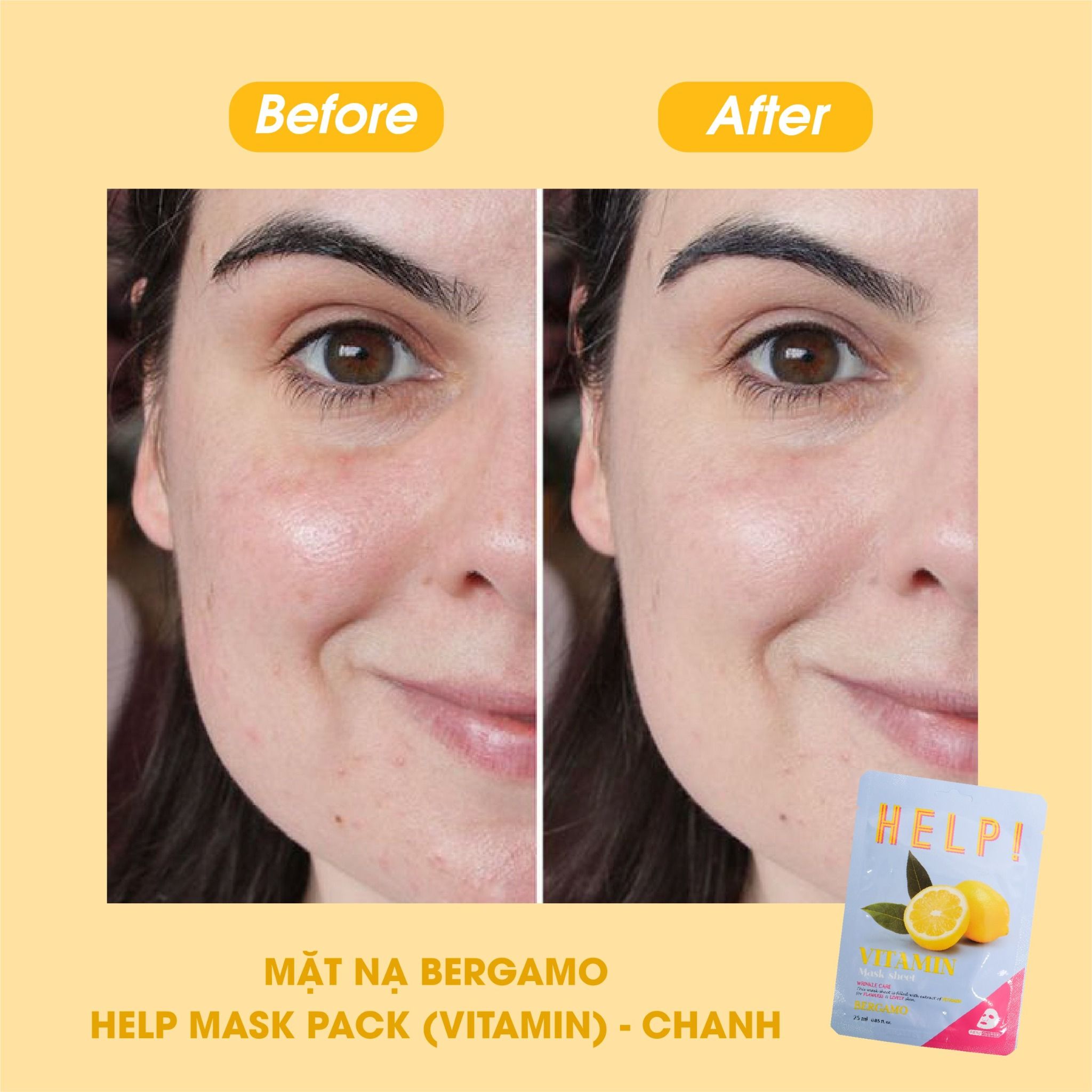 MẶT NẠ BERGAMO HELP MASK PACK VITAMIN - CHANH
