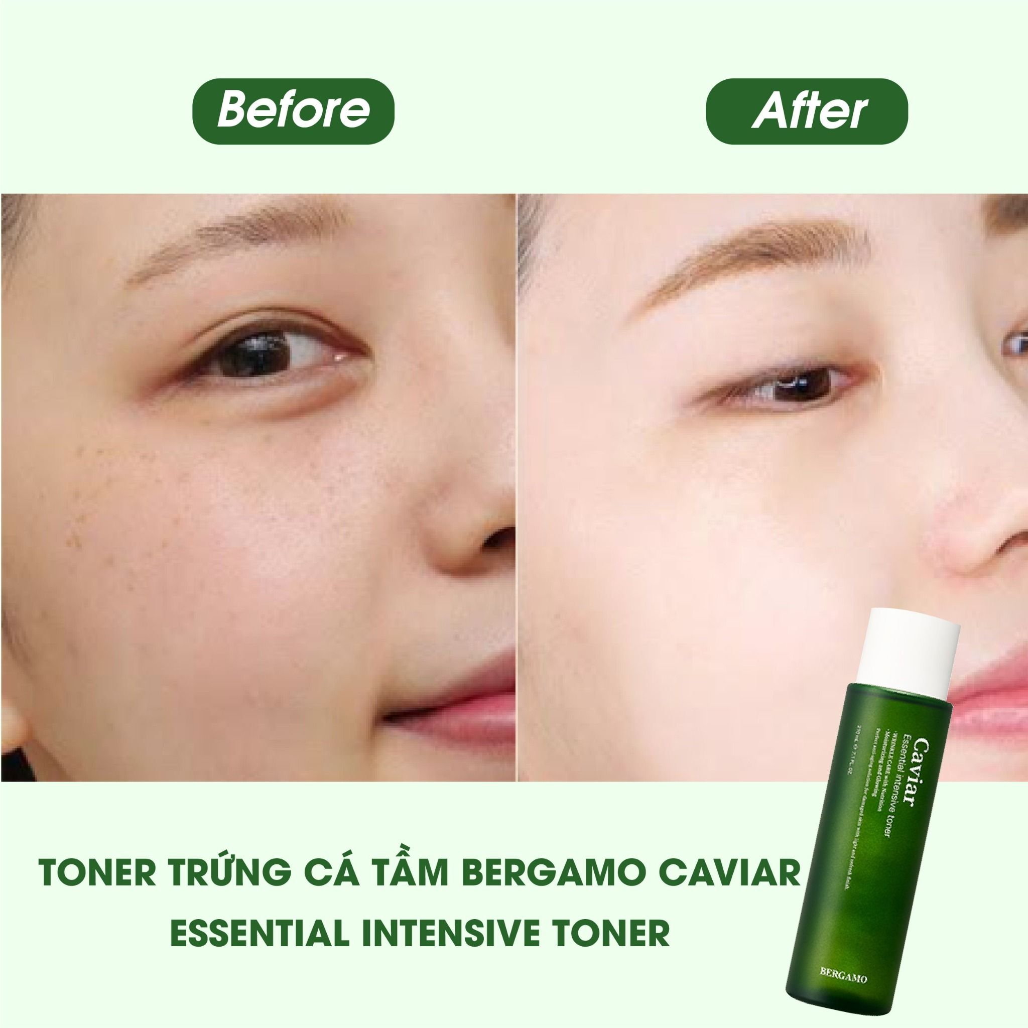 TONER TRỨNG CÁ TẦM BERGAMO CAVIAR ESSENTIAL INTENSIVE TONER 210ML
