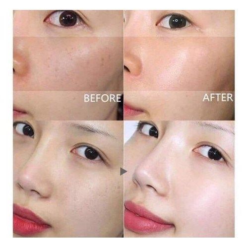 Nước Hoa Hồng Trị Nám Dongsung Rannce Skin 130ml