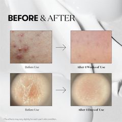 Tinh Chất Vi Kim Serum VT Cica Reedle Shot 300 50ml