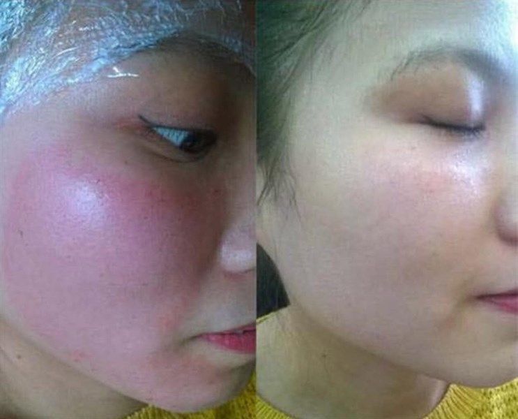 Mặt nạ SMAS Peptide Silk Mask 24h Hydration Boost 25g