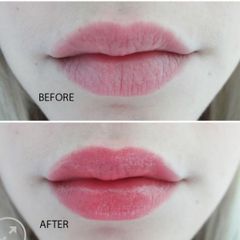Sáp Dưỡng Môi Hồng Xinh Vaseline Lip Therapy 7g