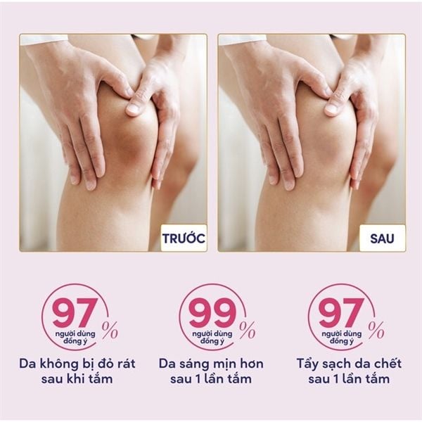 Tẩy Tế Bào Chết Dove Moisturizing Body Scrub 298g