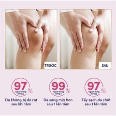 Tẩy Tế Bào Chết Dove Moisturizing Body Scrub 298g