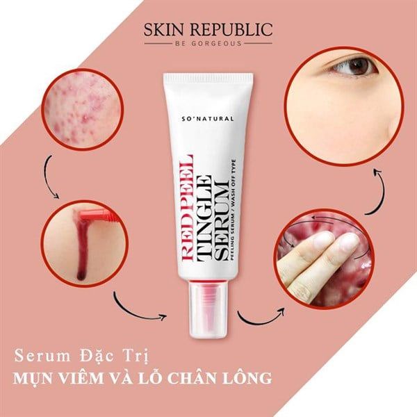 Tinh Chất Tái Tạo Phục Hồi Da Sinh Học So'Natural Red Peel Tingle Serum