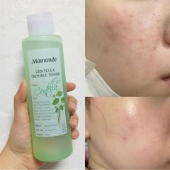 Nước Hoa Hồng Mamonde Rau Má Centella