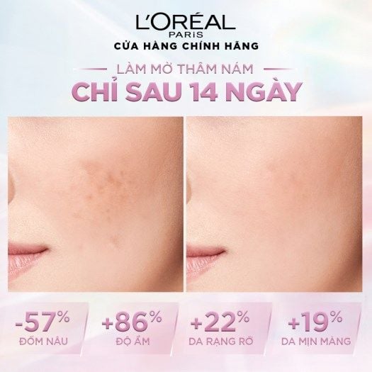 Tinh Chất Mờ Thâm Nám L'oreal Glycolic-Bright Instant Glowing Serum 30ml