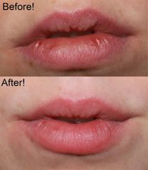 Tẩy Tế Bào Chết Môi Beauty Treats Sugar Lip Scrub 15g