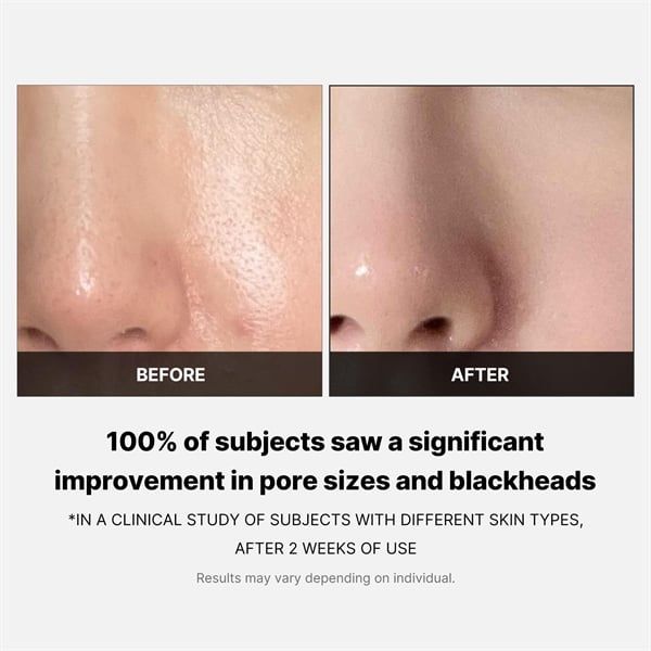 Toner Pad Medicube Zero Pore Pad 2.0 (70 miếng)
