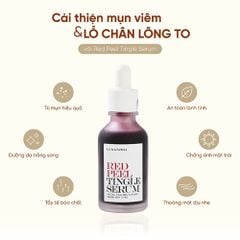 Tinh Chất Tái Tạo Phục Hồi Da Sinh Học So'Natural Red Peel Tingle Serum