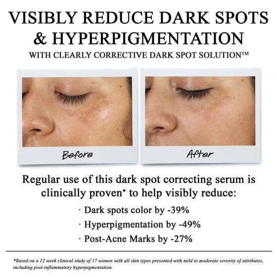 Tinh Chất Serum Làm Sáng Da & Mờ Thâm Mụn Kiehl's Clearly Corrective™ Dark Spot Solution