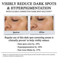 Tinh Chất Serum Làm Sáng Da & Mờ Thâm Mụn Kiehl's Clearly Corrective™ Dark Spot Solution