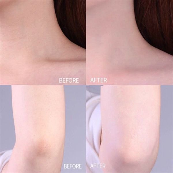 Sữa Dưỡng Thể Redwin Vitamin E Body Lotion With Evening Primrose Oil 400ml