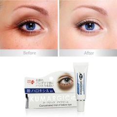 Kem Dưỡng Mắt Kumargic Eye Giảm Thâm 20g