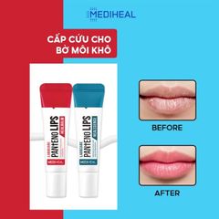Son dưỡng môi Mediheal Labocare Pantenolips Healbalm 10ml