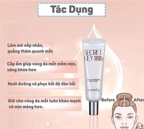 Kem Dưỡng Mắt Làm Trắng Và Ngăn Ngừa Lão Hóa Secret Key Starting Treatment Eye Cream 30g