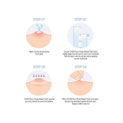 Miếng Dán Trị Mụn Ciracle Red Spot Acne Pimple Patch 24 miếng