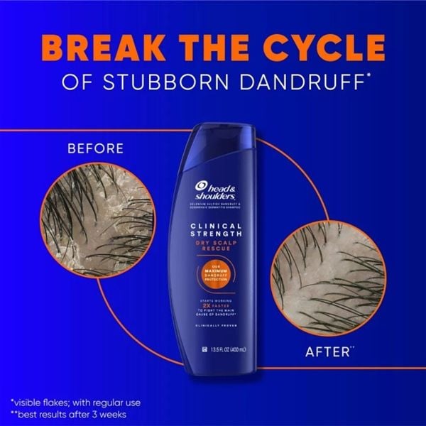 Dầu Gội Trị Gàu & Nấm Tóc Head & Shoulders Clinical Strength Dry Scalp Rescue Shampoo 400ml