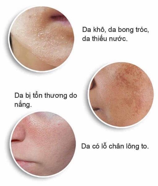 Tinh Chất Phục Hồi, Dưỡng Trắng Da Pretty Skin Hydra Max Serum B5 50ml