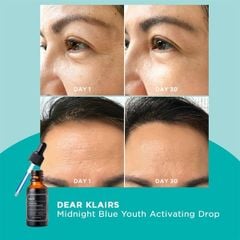 Tinh Chất Phục Hồi Da Klairs Midnight Blue Youth Activating Drop 20ml