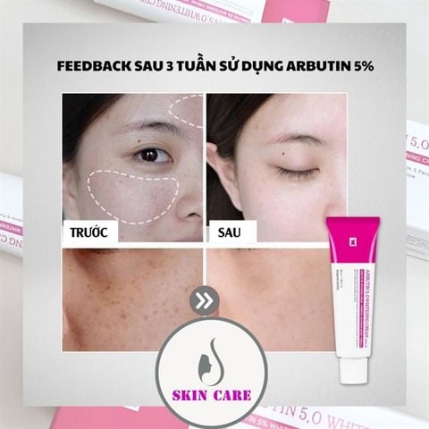 Kem Dưỡng Tosowoong Arbutin 5.0 Whitening Cream Dưỡng Trắng Da 50ml