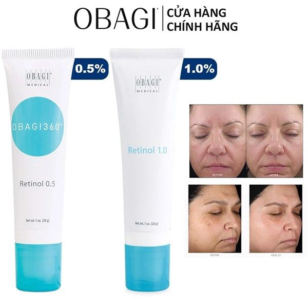 Kem dưỡng Trẻ Hóa Da, Ngừa Mụn Obagi 360 Retinol 28g