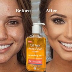 Sữa Rửa Mặt Cho Da Mụn Neutrogena Oil-Free Acne Wash