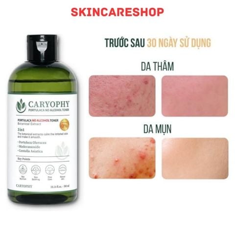 Nước hoa hồng làm giảm mụn và ngăn ngừa mụn Caryophy Portulaca Toner 300ml