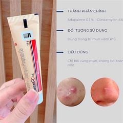 Gel Trị Mụn Trứng Cá Klenzit C 15g