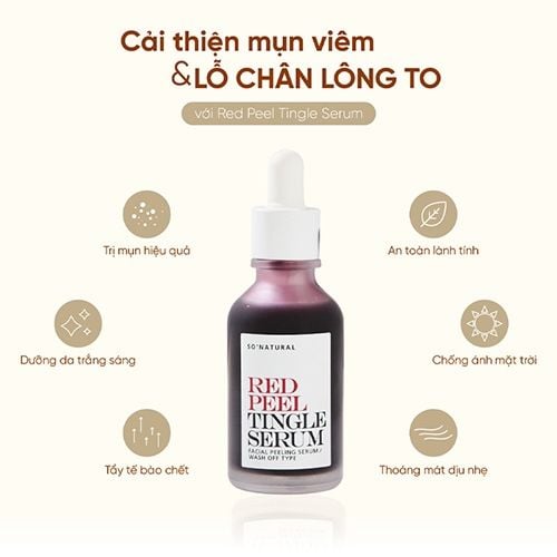 Tinh Chất Tái Tạo Phục Hồi Da Sinh Học So'Natural Red Peel Tingle Serum