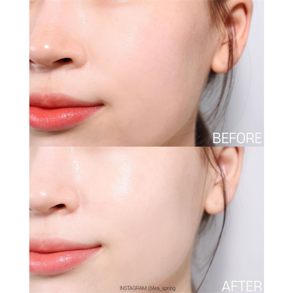 Kem Dưỡng Mờ Nám Chuyên Sâu Angel's Liquid Tranexamic Mela Cream