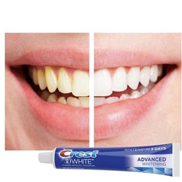 Kem đánh răng Crest 3D White Advanced Whitening 147gr