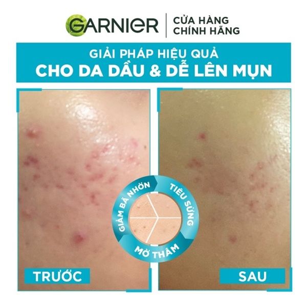 Tinh Chất Garnier Bright Complete Anti-Acnes Booster Serum 30ml