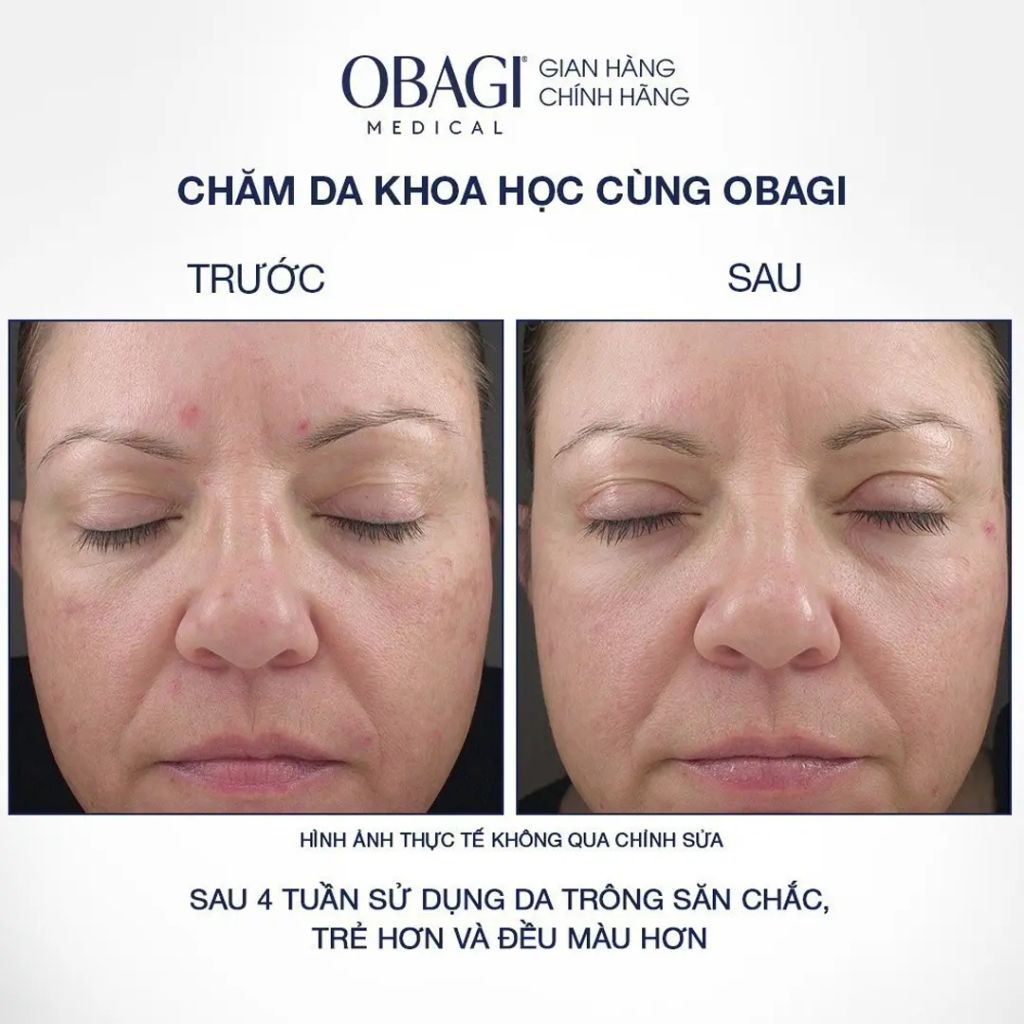 Kem dưỡng Trẻ Hóa Da, Ngừa Mụn Obagi 360 Retinol 28g