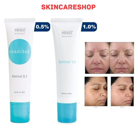 Kem dưỡng Trẻ Hóa Da, Ngừa Mụn Obagi 360 Retinol 28g