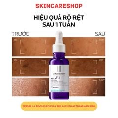 Serum La Roche-Possay Mela B3 Giảm Thâm Nám 30ml
