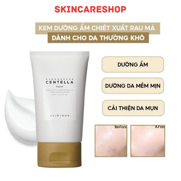 Kem Dưỡng Chiết Xuất Từ Rau Má Giảm Mụn, Phục Hồi Da Skin1004 Madagascar Centella Asiatica 100 Cream 75ml