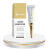 KEM TRỊ MỤN ACNE REMOVER RENOSKIN