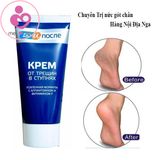 Kem trị nứt gót chân Kpem của Nga tuýp 50ml