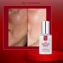 Huyết thanh tăng cường giảm nám, sạm A.M (Anti-Melasma) Boosting Serum (30ml) da tươi trẻ, trắng sáng chuẩn Hàn