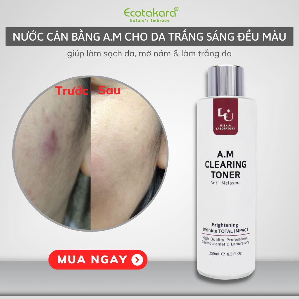Nước cân bằng detox làn da bị nám, vết thâm _ A.M (Anti-Melamsa) Clearing Toner (250ml)