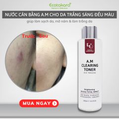 Nước cân bằng detox làn da bị nám, vết thâm _ A.M (Anti-Melamsa) Clearing Toner (250ml)
