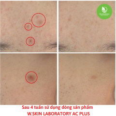 Kem dưỡng chuyên biệt dùng cho da dầu mụn AC+ CLEARING CREAM (60ml) {Có tem phụ nhập khẩu chính ngạch} giúp giảm mụn, mờ thâm mụn