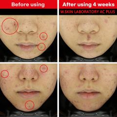 Kem dưỡng cho da bị mụn - AC+ CLEARING CREAM (60ml)