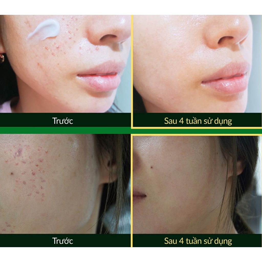 Kem dưỡng phục hồi da bị hư tổn và mệt mỏi - CICA PLUS REPAIR CREAM (50ml)