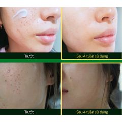 Kem dưỡng phục hồi da bị hư tổn và mệt mỏi - CICA PLUS REPAIR CREAM (50ml)