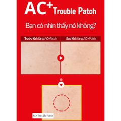 Vỉ lẻ Miếng dán mụn trứng cá - AC+ TROUBLE PATCH (12 miếng)