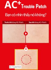 Miếng dán trị mụn giúp đẩy nhân mụn trứng cá, hạn chế thâm do mụn- AC+ TROUBLE PATCH (120 miếng) {Có tem phụ nhập khẩu chính ngạch}