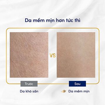 DOVE Sữa Tắm Phục Hồi Da Khô (Nâu) 500G