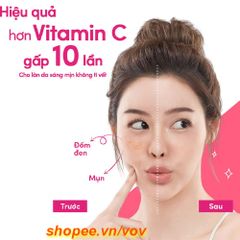POND'S kem dưỡng trắng da trắng hồng rạng rỡ ngày 30g